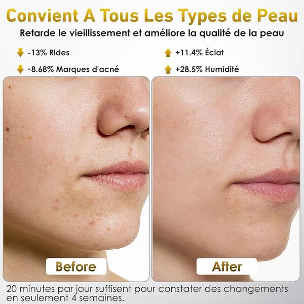 Masque LED Visage Et Cou, Ntyikul LED Visage avec 7 Couleurs de Lumière et 5 Niveaux de Luminosité, LED Mask avec Télécommande, pour Tous Types de Peau, pour Anti-Age, Illumine Le Teint